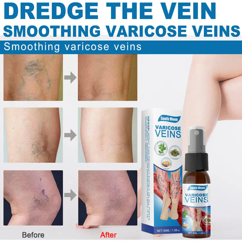 Varicose Veins Spray TK